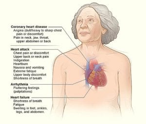 Women and heart disease; the silent epidemic