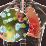 Coronavirus mortality rate